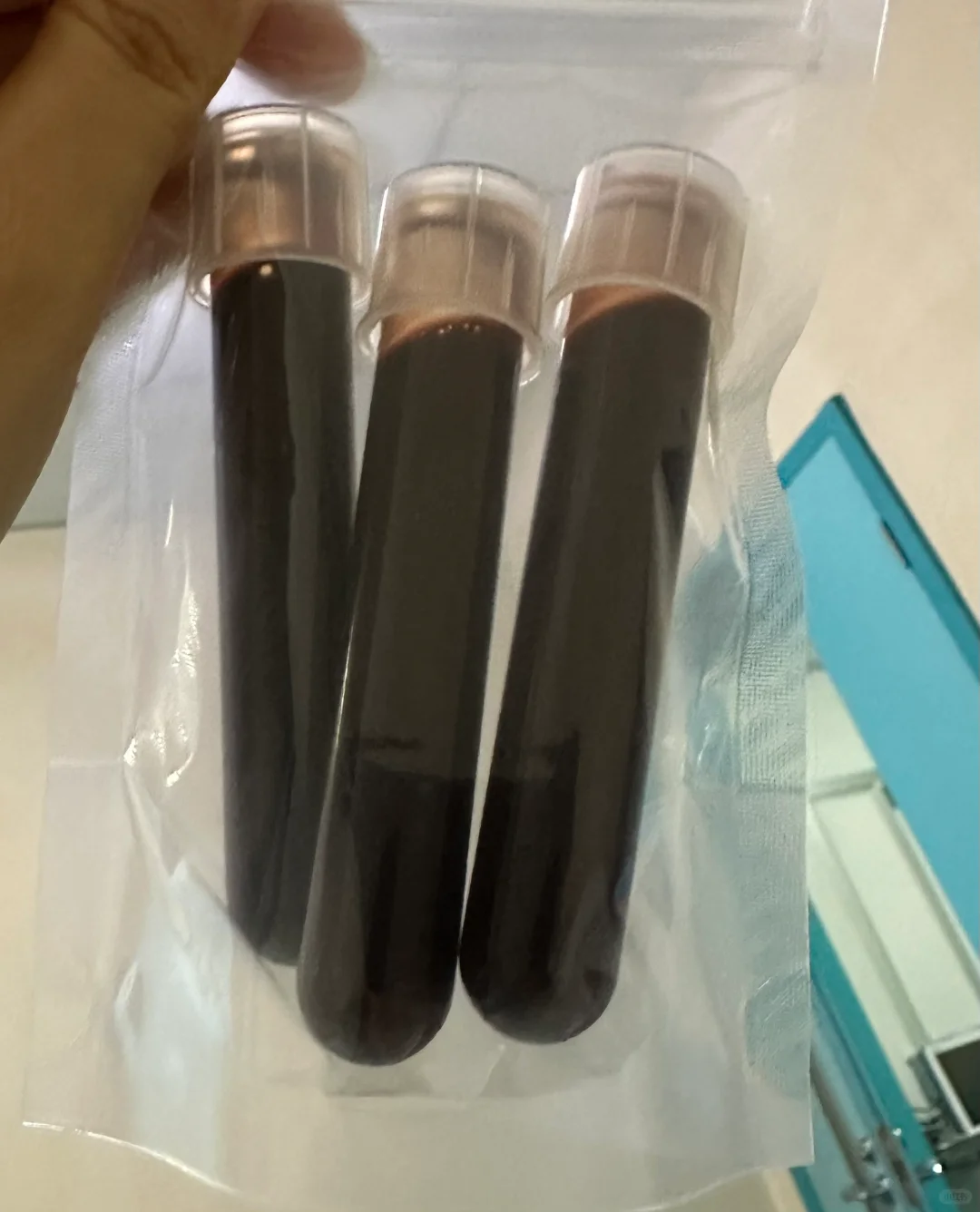 巧囊穿刺了,哪里做代孕做的好，国内代妈咨询