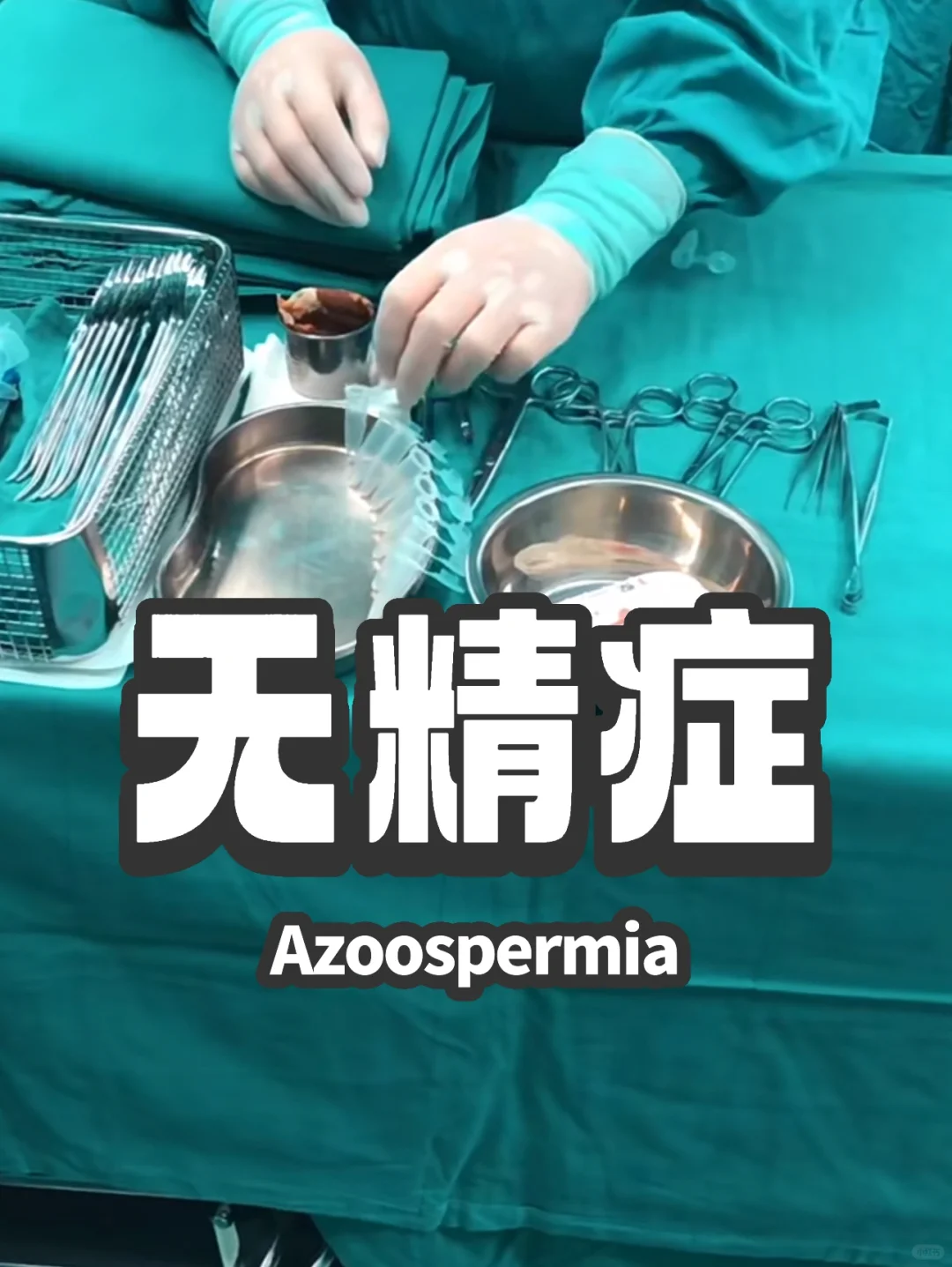 【留言回复】检查两次，一个精子都没有？！,三代试管代孕医生_供卵试管代孕须知